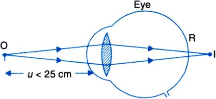 
(i) Range of normal vision: Due to accommodation property of the lens