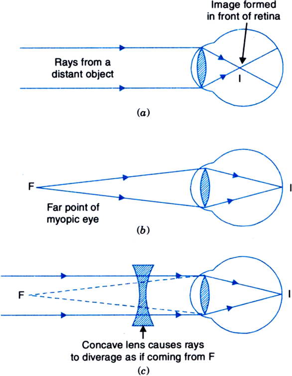 Defect Correction Is The Remediation Of A