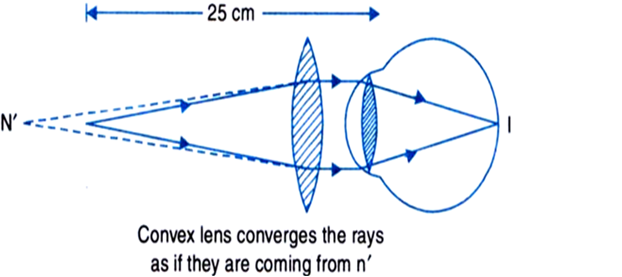
Calculation of focal length and power of correcting lens in hypermetr